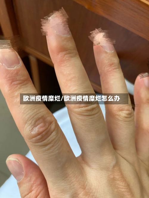 欧洲疫情糜烂/欧洲疫情糜烂怎么办-第2张图片
